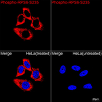 Phospho-S6 (Ser235) Antibody in Immunocytochemistry (ICC/IF)