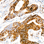 Phospho-S6 (Ser235) Antibody in Immunohistochemistry (Paraffin) (IHC (P))