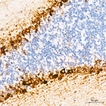 Phospho-S6 (Ser235) Antibody in Immunohistochemistry (Paraffin) (IHC (P))