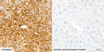 Phospho-S6 (Ser235) Antibody in Immunohistochemistry (Paraffin) (IHC (P))