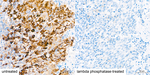 Phospho-S6 (Ser235) Antibody in Immunohistochemistry (Paraffin) (IHC (P))