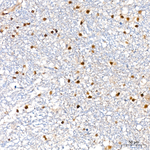 Phospho-ATP Citrate Lyase (Ser455) Antibody in Immunohistochemistry (Paraffin) (IHC (P))