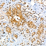 Phospho-ATP Citrate Lyase (Ser455) Antibody in Immunohistochemistry (Paraffin) (IHC (P))