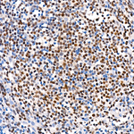 Phospho-ATP Citrate Lyase (Ser455) Antibody in Immunohistochemistry (Paraffin) (IHC (P))