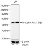 Phospho-ATP Citrate Lyase (Ser455) Antibody in Western Blot (WB)