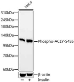 Phospho-ATP Citrate Lyase (Ser455) Antibody in Western Blot (WB)