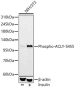 Phospho-ATP Citrate Lyase (Ser455) Antibody in Western Blot (WB)