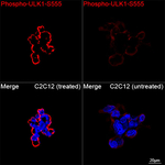 Phospho-ULK1 (Ser555) Recombinant Rabbit Monoclonal Antibody (8I9C3)