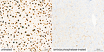 Phospho-Nrf2 (Ser40) Antibody in Immunohistochemistry (Paraffin) (IHC (P))