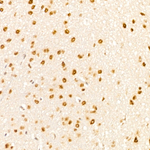 Phospho-p38 MAPK (Thr180) Antibody in Immunohistochemistry (Paraffin) (IHC (P))
