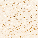 Phospho-p38 MAPK (Thr180) Antibody in Immunohistochemistry (Paraffin) (IHC (P))