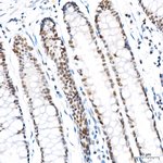 Phospho-LATS1/LATS2 (Thr1079, Thr1041) Antibody in Immunohistochemistry (Paraffin) (IHC (P))