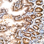 Phospho-LATS1/LATS2 (Thr1079, Thr1041) Antibody in Immunohistochemistry (Paraffin) (IHC (P))
