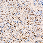 Phospho-LATS1/LATS2 (Thr1079, Thr1041) Antibody in Immunohistochemistry (Paraffin) (IHC (P))