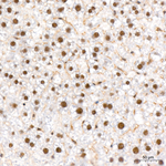 Phospho-LATS1/LATS2 (Thr1079, Thr1041) Antibody in Immunohistochemistry (Paraffin) (IHC (P))