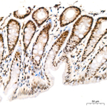 Phospho-LATS1/LATS2 (Thr1079, Thr1041) Antibody in Immunohistochemistry (Paraffin) (IHC (P))