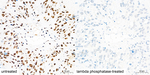 Phospho-LATS1/LATS2 (Thr1079, Thr1041) Antibody in Immunohistochemistry (Paraffin) (IHC (P))