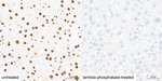 Phospho-LATS1/LATS2 (Thr1079, Thr1041) Antibody in Immunohistochemistry (Paraffin) (IHC (P))