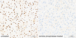 Phospho-LATS1/LATS2 (Thr1079, Thr1041) Antibody in Immunohistochemistry (Paraffin) (IHC (P))