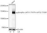 Phospho-LATS1/LATS2 (Thr1079, Thr1041) Antibody in Western Blot (WB)