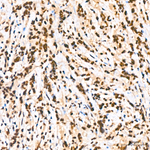 Phospho-SMAD1 (Ser463, Ser465, Ser467) Antibody in Immunohistochemistry (Paraffin) (IHC (P))