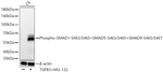 Phospho-SMAD1 (Ser463, Ser465, Ser467) Antibody in Western Blot (WB)