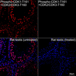 Phospho-CDK1/CDK2/CDK3 (Thr161, Thr160) Antibody in Immunohistochemistry (Paraffin) (IHC (P))
