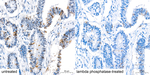 Phospho-CDK1/CDK2/CDK3 (Thr161, Thr160) Antibody in Immunohistochemistry (Paraffin) (IHC (P))