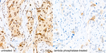 Phospho-CDK1/CDK2/CDK3 (Thr161, Thr160) Antibody in Immunohistochemistry (Paraffin) (IHC (P))