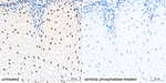 Phospho-CDK1/CDK2/CDK3 (Thr161, Thr160) Antibody in Immunohistochemistry (Paraffin) (IHC (P))