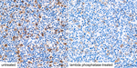 Phospho-CDK1/CDK2/CDK3 (Thr161, Thr160) Antibody in Immunohistochemistry (Paraffin) (IHC (P))