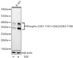 Phospho-CDK1/CDK2/CDK3 (Thr161, Thr160) Antibody in Western Blot (WB)