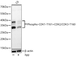 Phospho-CDK1/CDK2/CDK3 (Thr161, Thr160) Antibody in Western Blot (WB)