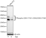 Phospho-CDK1/CDK2/CDK3 (Thr161, Thr160) Antibody in Western Blot (WB)