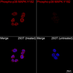 Phospho-p38 MAPK (Tyr182) Recombinant Rabbit Monoclonal Antibody (1H2R6)