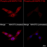 Phospho-p38 MAPK (Tyr182) Antibody in Immunocytochemistry (ICC/IF)
