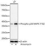 Phospho-p38 MAPK (Tyr182) Antibody in Western Blot (WB)