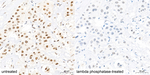 Phospho-STAT5 alpha/beta (Tyr694) Antibody in Immunohistochemistry (Paraffin) (IHC (P))
