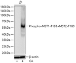 Phospho-MST1/MST2 (Thr183, Thr180) Antibody in Western Blot (WB)