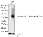 Phospho-MST1/MST2 (Thr183, Thr180) Antibody in Western Blot (WB)