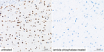 Phospho-C/EBP beta (Thr235) Antibody in Immunohistochemistry (Paraffin) (IHC (P))