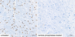 Phospho-C/EBP beta (Thr235) Antibody in Immunohistochemistry (Paraffin) (IHC (P))