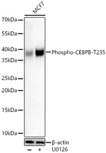 Phospho-C/EBP beta (Thr235) Antibody in Western Blot (WB)