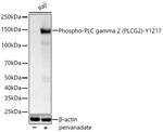 Phospho-PLCG2 (Tyr1217) Antibody in Western Blot (WB)