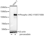 Phospho-JAK2 (Tyr1007, Tyr1008) Recombinant Rabbit Monoclonal Antibody (8O0C2)