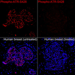 Phospho-ATR (Ser428) Antibody in Immunohistochemistry (Paraffin) (IHC (P))