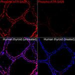 Phospho-ATR (Ser428) Recombinant Rabbit Monoclonal Antibody (10P5F8)