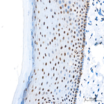 Phospho-ATR (Ser428) Antibody in Immunohistochemistry (Paraffin) (IHC (P))
