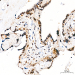 Phospho-ATR (Ser428) Antibody in Immunohistochemistry (Paraffin) (IHC (P))