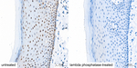 Phospho-ATR (Ser428) Antibody in Immunohistochemistry (Paraffin) (IHC (P))